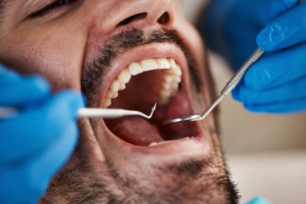 Best Emergency Dental Care for Abscessed Tooth in Houserville, PA